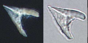 Ceratolithus armatus (Light Microscope image).