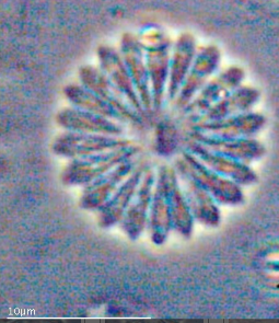 Discoaster multiradiatus-Light Microscope Image.